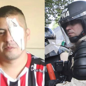 Identificaron al prefecto que le disparó en el ojo a Jonathan Navarro