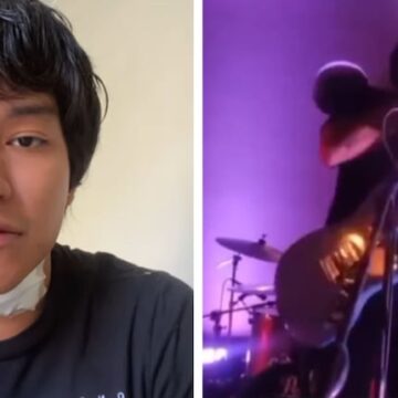 Declaraciones del músico peruano electrocutado en concierto: «No terminó de forma fatal por mera suerte»