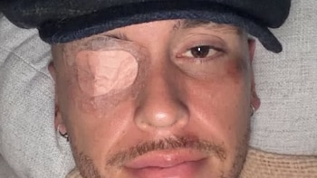 imagen-425 Lucas Ocampos enfrenta un nuevo desafío médico con parálisis facial