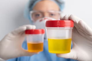 imagen-5 Aumento del calor: la importancia del color de la orina en la hidratación