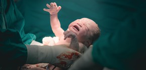 imagen-228 Investigación sobre analgesia epidural en partos revela que no causa daño neurológico en neonatos
